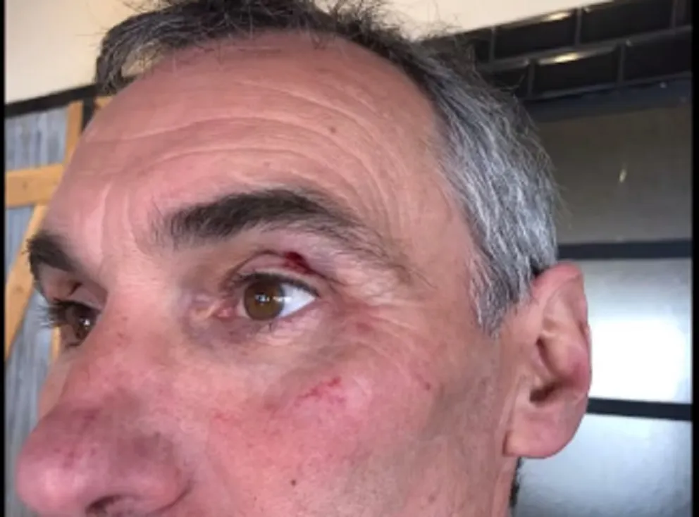 Agresión a un comerciante del centro: “piensan que la forma de actuar es con violencia”