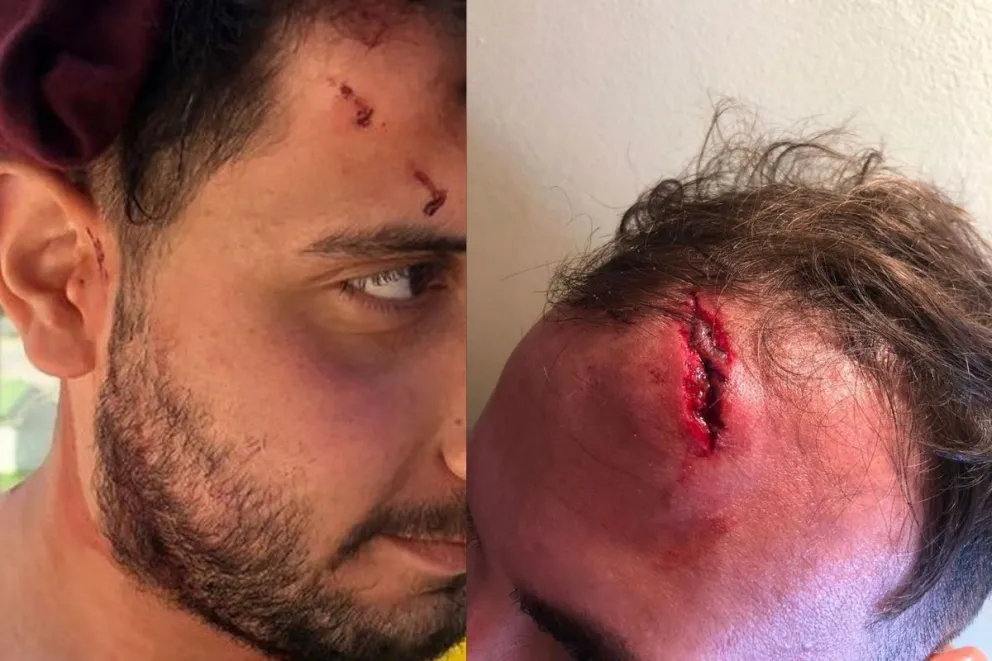 "No podemos permitir una postura pasiva ante la agresión de un grupo minúsculo de violentos"