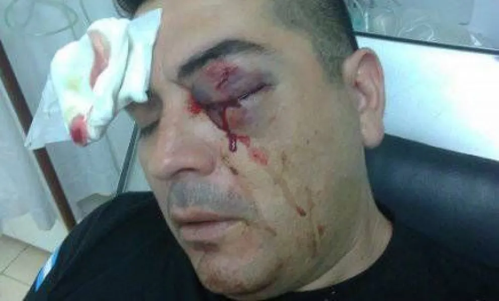 Sigue internado policía herido durante procedimiento