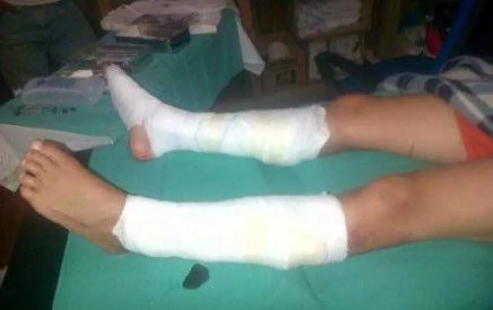 Atropellan a dos niños que nadaban en el Lago Traful
