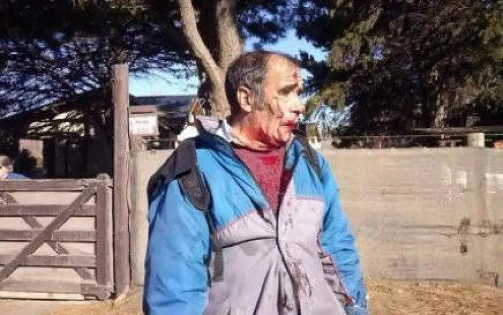 Mejora el cartero mordido y sacrificaron uno de los perros