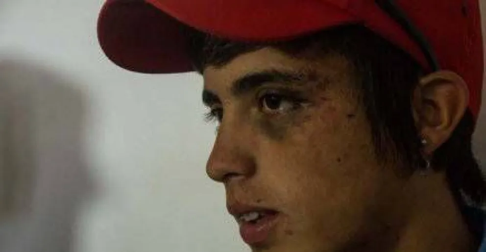 Jóvenes denuncian golpiza policial