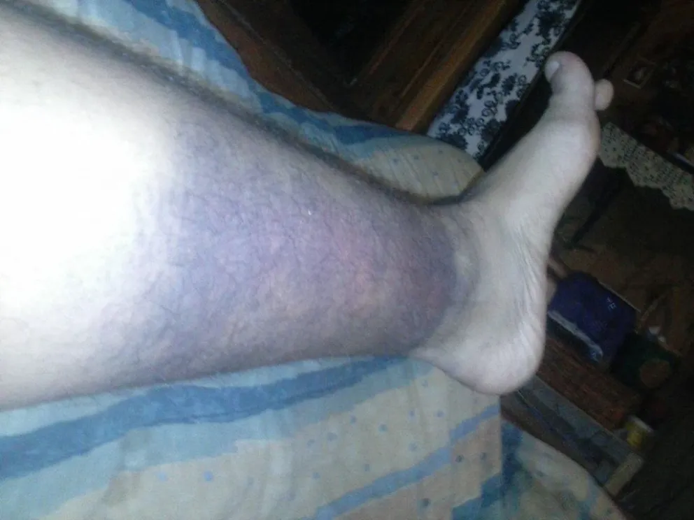 Seis jóvenes denunciaron haber digo golpeados por policías,