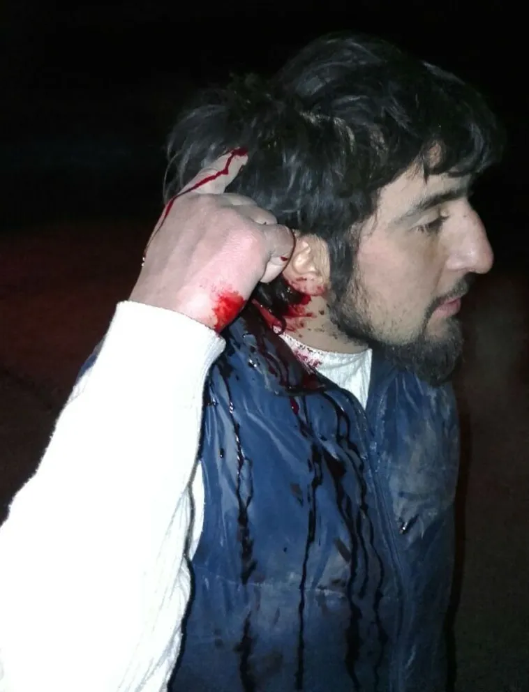 Tras una pelea, un hombre resultó herido de un flechazo