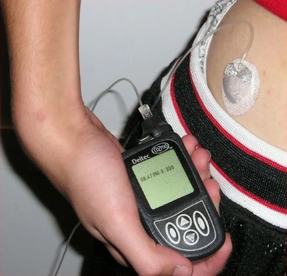 Obligan a obra social a entregar micro infusor de insulina