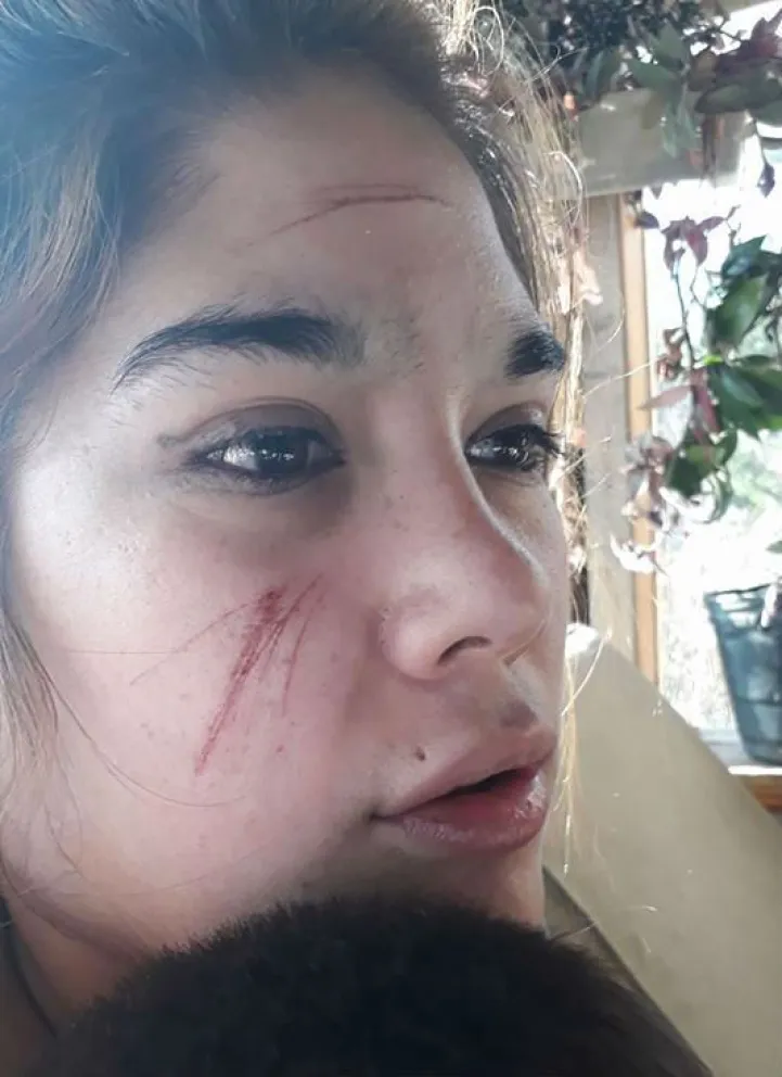 Una chica fue atacada en la vía pública por dos hombres