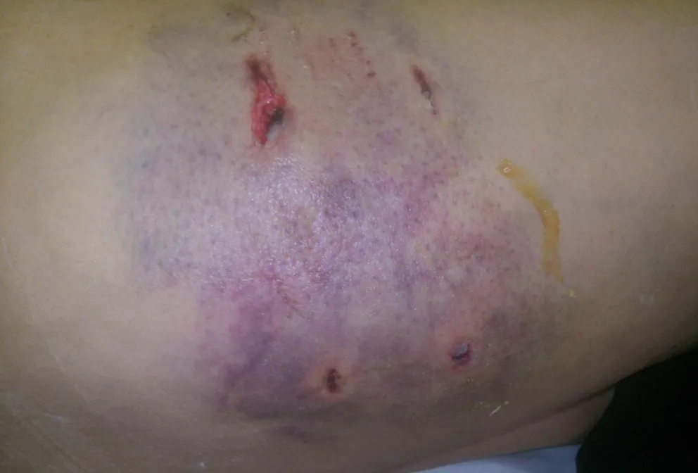 Cuatro perros atacaron ferozmente a una mujer