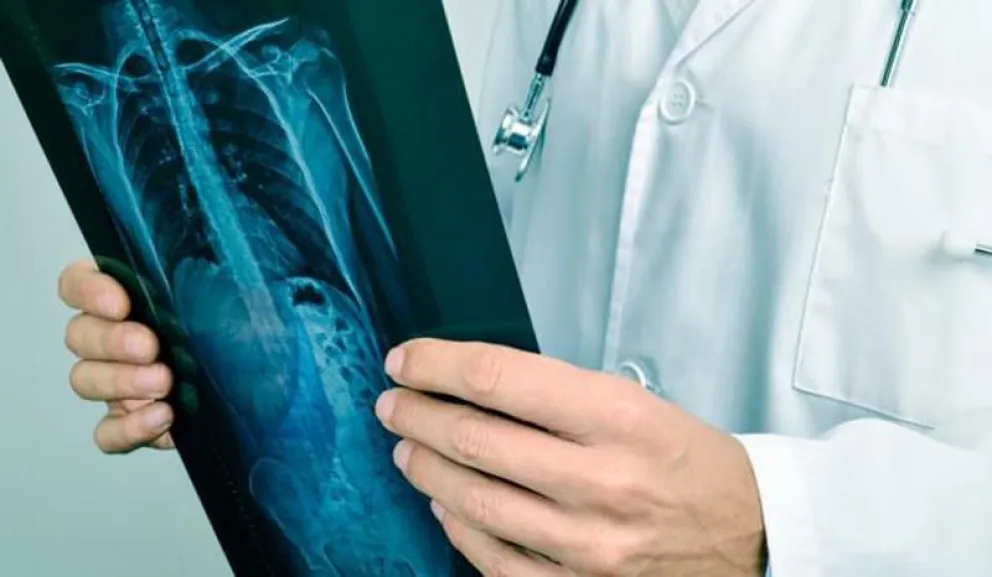 Mueren 20 personas por día por cáncer de colon