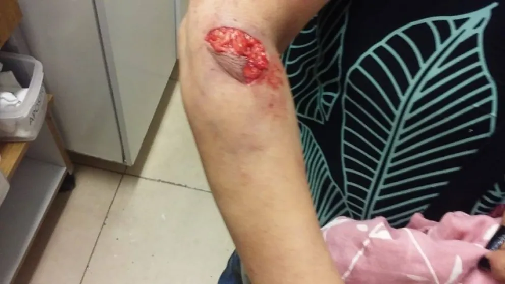 La mujer sufrió graves lesiones. 