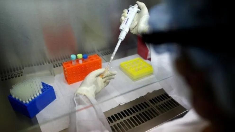 El Ministerio de Salud informó que ya son 101 los muertos por coronavirus en Argentina