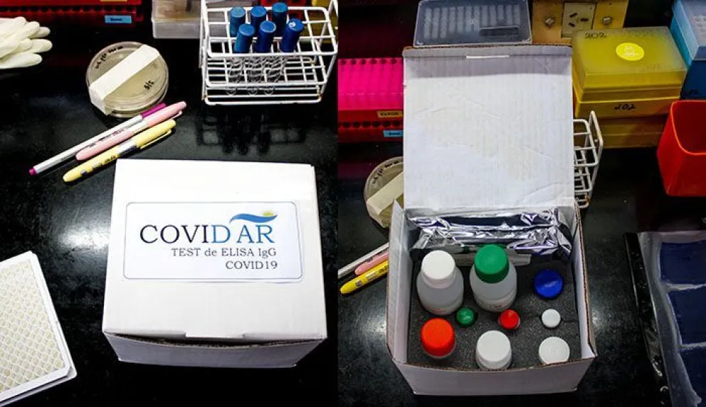 Investigadores argentinos logran desarrollar el primer test serológico del país para el coronavirus