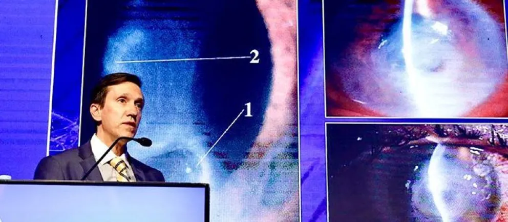 Hallan receptores de entrada del virus de covid-19 en la superficie ocular