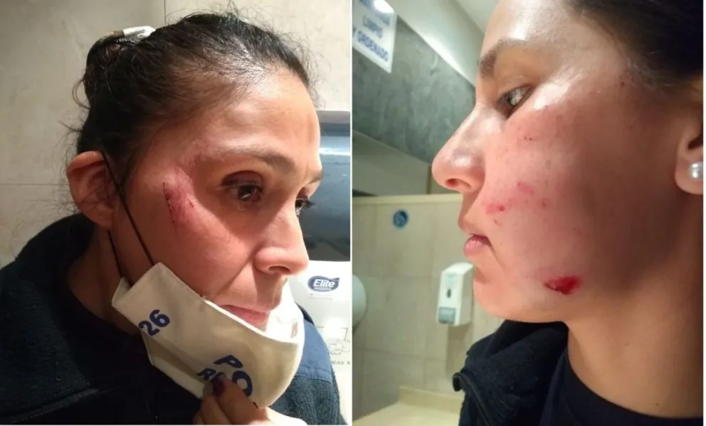 Dos detenidos por agredir a un hombre y atacar al personal policial