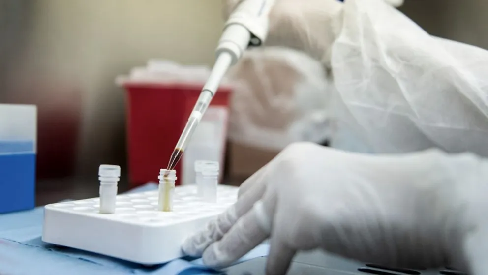 Argentina fue elegida para probar una vacuna contra el coronavirus