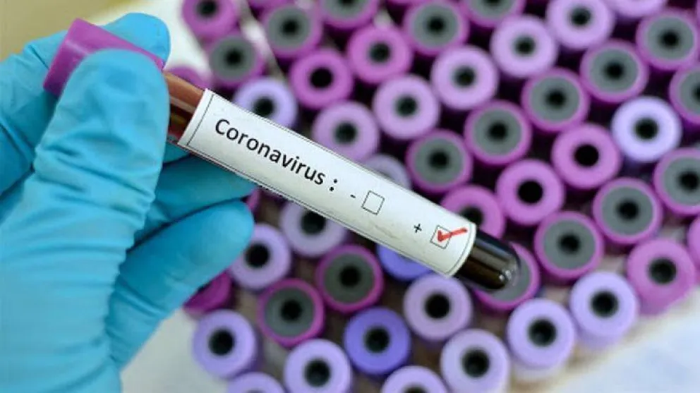 Covid-19: Confirman 4 nuevas muertes en Río Negro