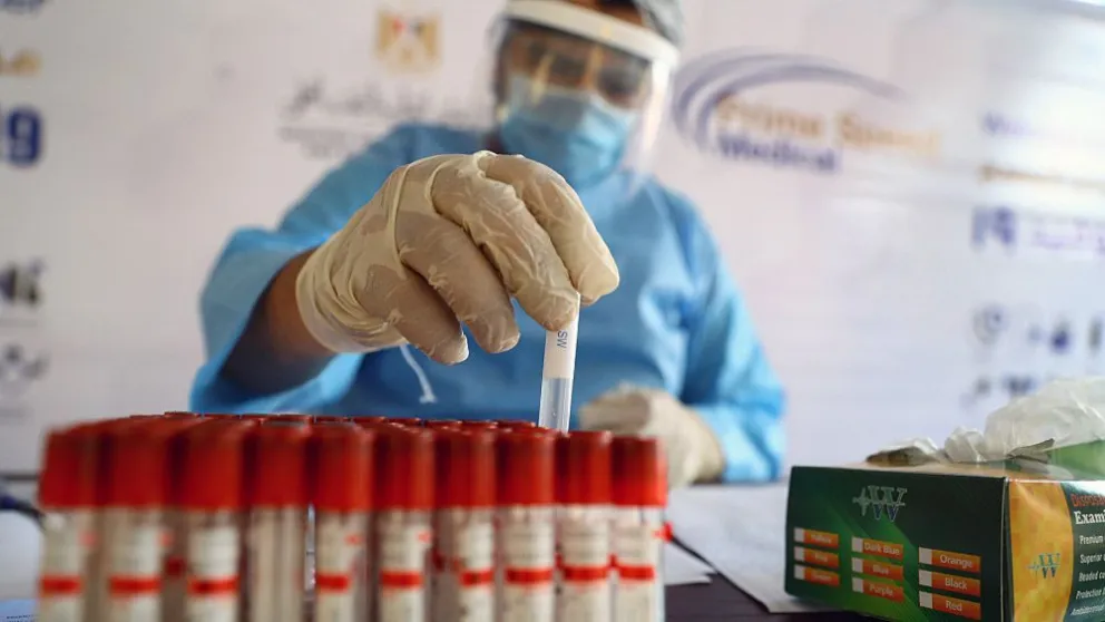 Detectan cinco casos de la variante Delta en Argentina sin nexo con viajeros